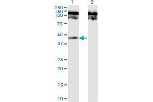 Western Blot analysis of TNFRSF19 expression in transfected 293T cell line by TNFRSF19 monoclonal antibody (M02), clone 1H6. (TNFRSF19 Antikörper  (AA 30-119))