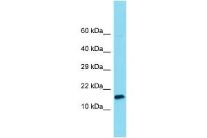 Host: Rabbit Target Name: MNF1 Sample Type: 293T Whole Cell lysates Antibody Dilution: 1.
