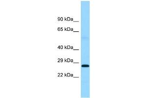 WB Suggested Anti-FTMT Antibody Titration: 1. (Ferritin Mitochondrial Antikörper  (Middle Region))