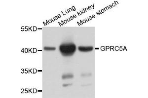 Western blot analysis of extract of various cells, using GPRC5A antibody. (GPRC5A Antikörper)