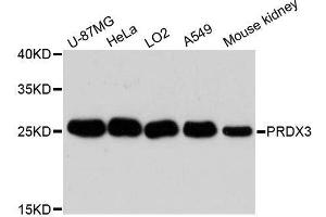 Western blot analysis of extracts of various cell lines, using PRDX3 antibody. (Peroxiredoxin 3 Antikörper  (AA 63-256))