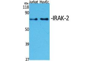 Western Blot (WB) analysis of specific cells using IRAK-2 Polyclonal Antibody. (IRAK2 Antikörper  (Internal Region))