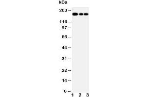 Western blot testing of MRP1 antibody and Lane 1:  Jurkat;  2: CEM;  3: A549