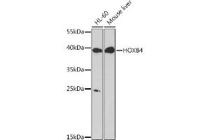 Western blot analysis of extracts of various cell lines, using HOXB4 Rabbit pAb (ABIN7267768) at 1:1000 dilution. (HOXB4 Antikörper  (AA 50-150))