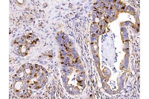 IHC analysis of Geminin/GMNN using anti-Geminin/GMNN antibody (ABIN7600598). (Geminin Antikörper  (AA 21-196))