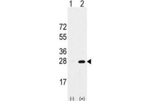 Western Blotting (WB) image for anti-Proteasome Subunit alpha 5 (PSMA5) antibody (ABIN2998030) (PSMA5 Antikörper)