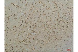 Immunohistochemistry (IHC) analysis of paraffin-embedded Mouse Brain Tissue using Cav1. (CACNA1C Antikörper)