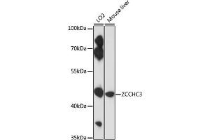 Western blot analysis of extracts of various cell lines, using ZCCHC3 antibody (ABIN7271543) at 1:3000 dilution. (ZCCHC3 Antikörper  (AA 215-335))