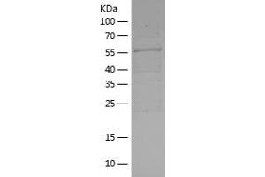 PRKAB2 Protein (AA 1-272) (His-IF2DI Tag)