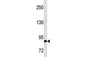 Western Blotting (WB) image for anti-Matrix Metallopeptidase 9 (Gelatinase B, 92kDa Gelatinase, 92kDa Type IV Collagenase) (MMP9) antibody (ABIN3031727)