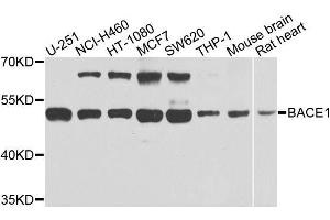 Western blot analysis of extracts of various cell lines, using BACE1 antibody. (BACE1 Antikörper  (AA 22-322))