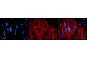 Rabbit Anti-AKAP7 Antibody    Formalin Fixed Paraffin Embedded Tissue: Human Adult heart  Observed Staining: Membrane, Cytoplasmic Primary Antibody Concentration: 1:600 Secondary Antibody: Donkey anti-Rabbit-Cy2/3 Secondary Antibody Concentration: 1:200 Magnification: 20X Exposure Time: 0. (AKAP7 Antikörper  (Middle Region))
