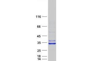 Western Blotting (WB) image for Sirtuin 5 (SIRT5) (Transcript Variant 1) protein (Myc-DYKDDDDK Tag) (ABIN2732082)