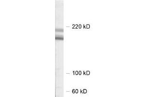 dilution: 1 : 1000, sample: rat hippocampus homogenate