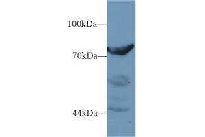Detection of DPP3 in Rat Placenta lysate using Polyclonal Antibody to Dipeptidyl Peptidase 3 (DPP3) (DPP3 Antikörper  (AA 2-261))
