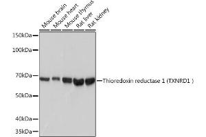 Western blot analysis of extracts of various cell lines, using Thioredoxin reductase 1 (Thioredoxin reductase 1 (TXNRD1 ) ) Rabbit mAb (ABIN7270805) at 1:1000 dilution. (TXNRD1 Antikörper)
