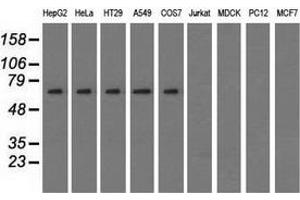 Western blot analysis of extracts (35 µg) from 9 different cell lines by using anti-SNX9 monoclonal antibody. (SNX9 Antikörper)