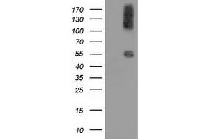 Western Blotting (WB) image for anti-Calcium Binding and Coiled-Coil Domain 2 (CALCOCO2) antibody (ABIN1497078) (CALCOCO2 Antikörper)