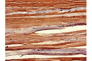 IHC image of ABIN7155848 diluted at 1:400 and staining in paraffin-embedded human skeletal muscle tissue performed on a Leica BondTM system. (SIX Homeobox 1 Antikörper  (AA 144-262))