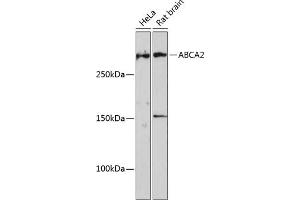 Western blot analysis of extracts of various cell lines, using  Polyclonal Antibody (ABIN7265728) at 1:1000 dilution.