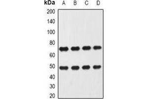 Western blot analysis of Heparanase expression in Hela (A), MCF7 (B), mouse liver (C), mouse lung (D) whole cell lysates. (HPSE Antikörper)