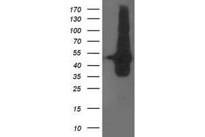 HEK293T cells were transfected with the pCMV6-ENTRY control (Left lane) or pCMV6-ENTRY DOK2 (Right lane) cDNA for 48 hrs and lysed. (DOK2 Antikörper)