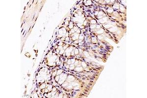 Immunohistochemistry of paraffin embedded mouse colon using DMRTA2 (ABIN7073753) at dilution of 1: 700 (400x lens) (DMRTA2 Antikörper)