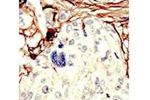 Immunohistochemistry (IHC) image for anti-serine/threonine Kinase 11 (STK11) (AA 387-417) antibody (ABIN3029003)