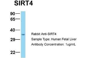 Host:  Rabbit  Target Name:  SIRT4  Sample Type:  Human Fetal Liver  Antibody Dilution:  1. (SIRT4 Antikörper  (N-Term))