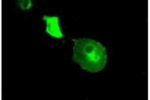 Image no. 4 for anti-Crystallin, alpha B (CRYAB) antibody (ABIN1497641) (CRYAB Antikörper)