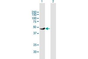Western Blot analysis of HKDC1 expression in transfected 293T cell line by HKDC1 MaxPab polyclonal antibody. (HKDC1 Antikörper  (AA 1-427))