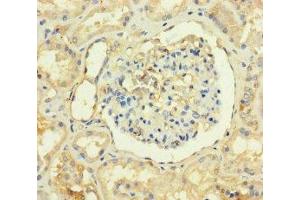 Immunohistochemistry of paraffin-embedded human kidney tissue using ABIN7173277 at dilution of 1:100 (TMEM82 Antikörper  (AA 168-202))