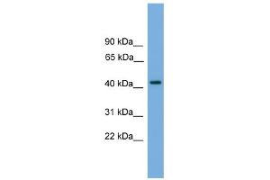 WB Suggested Anti-PALM Antibody Titration: 0. (Paralemmin Antikörper  (N-Term))