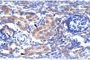 Immunohistochemical staining (Formalin-fixed paraffin-embedded sections) of human kidney with KCNAB3 polyclonal antibody  at 4-8 ug/mL working concentration. (KCNAB3 Antikörper  (N-Term))