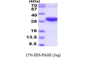 SDS-PAGE (SDS) image for Synaptotagmin I (SYT1) (AA 136-382) protein (His tag) (ABIN6386765)