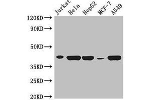 Western Blot Positive WB detected in: Jurkat whole cell lysate, Hela whole cell lysate, HepG2 whole cell lysate, MCF-7 whole cell lysate, A549 whole cell lysate All lanes: HLA-B antibody at 3 μg/mL Secondary Goat polyclonal to rabbit IgG at 1/50000 dilution Predicted band size: 41 kDa Observed band size: 41 kDa (HLA-B Antikörper  (AA 25-308))