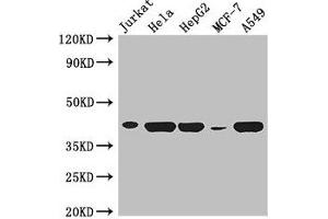 Western Blot Positive WB detected in: Jurkat whole cell lysate, Hela whole cell lysate, HepG2 whole cell lysate, MCF-7 whole cell lysate, A549 whole cell lysate All lanes: HLA-B antibody at 3 μg/mL Secondary Goat polyclonal to rabbit IgG at 1/50000 dilution Predicted band size: 41 kDa Observed band size: 41 kDa