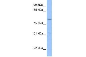 Human HepG2; WB Suggested Anti-ZNF342 Antibody Titration: 0. (Zinc Finger Protein 296 (ZNF296) (Middle Region) Antikörper)