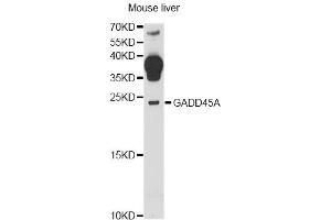 Western blot analysis of extracts of mouse liver, using GADD45A antibody (ABIN6292100) at 1:1000 dilution. (GADD45A Antikörper)
