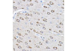 Immunohistochemistry of paraffin-embedded rat brain using PTPN23 Rabbit pAb (ABIN1682396, ABIN3019081, ABIN3019082 and ABIN6220704) at dilution of 1:100 (40x lens).