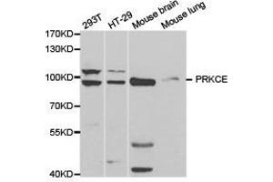 Western Blotting (WB) image for anti-Protein Kinase C, epsilon (PRKCE) antibody (ABIN1874300) (PKC epsilon Antikörper)