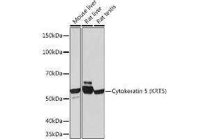 Western blot analysis of extracts of various cell lines, using Cytokeratin 5 (KRT5) (KRT5) Rabbit mAb (ABIN7268103) at 1:1000 dilution. (Cytokeratin 5 Antikörper)