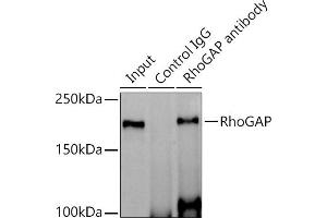 Immunoprecipitation analysis of 600 μg extracts of Mouse brain cells using 3 μg RhoGAP antibody (ABIN1682830, ABIN3016006, ABIN3016007 and ABIN7101474). (ARHGAP5 Antikörper)