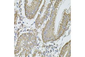 Immunohistochemistry (Paraffin-embedded Sections) (IHC (p)) image for anti-Filamin B, beta (FLNB) (AA 1686-1785) antibody (ABIN1679857)