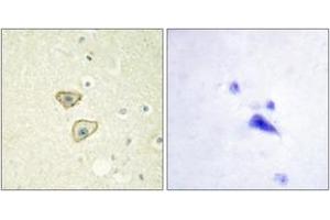 Immunohistochemistry analysis of paraffin-embedded human brain tissue, using EGFR (Ab-1016) Antibody. (EGFR Antikörper  (AA 986-1035))