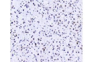 IHC analysis of POLR2A using anti-POLR2A antibody (ABIN7599598).