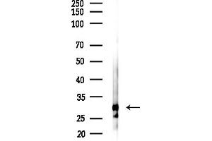 Western blot analysis of lysates from HepG2 cells(LPS,4h treatment), using NQO1 Antibody at 1/1000 dilution.