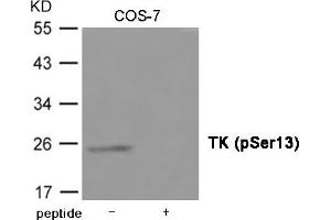 Western blot analysis of extracts from COS-7 cells using TK (Phospho-Ser13) Antibody. (TK1 Antikörper  (pSer13))