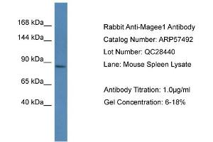 Western Blotting (WB) image for anti-Melanoma Antigen Family E, 1 (MAGEE1) (C-Term) antibody (ABIN785900) (MAGEE1 Antikörper  (C-Term))