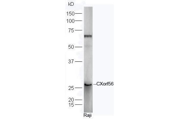 CXorf56 Antikörper  (AA 120-170)